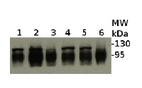 ClpB-P | ClpB3 in the group Antibodies for Plant/Algal / Environmental Stress / Heat shock at Agrisera AB (Antibodies for research) (AS09 459)